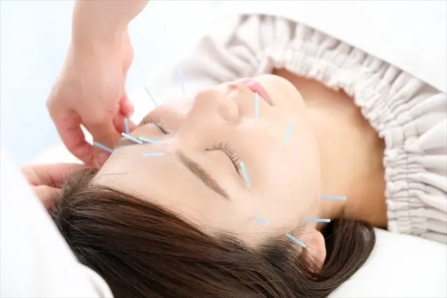 美容鍼ひたちなか施術イメージ１